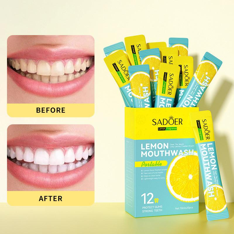 Lemon Fresh Mouthwash Box - 10mL x 20 - Trendy Mix