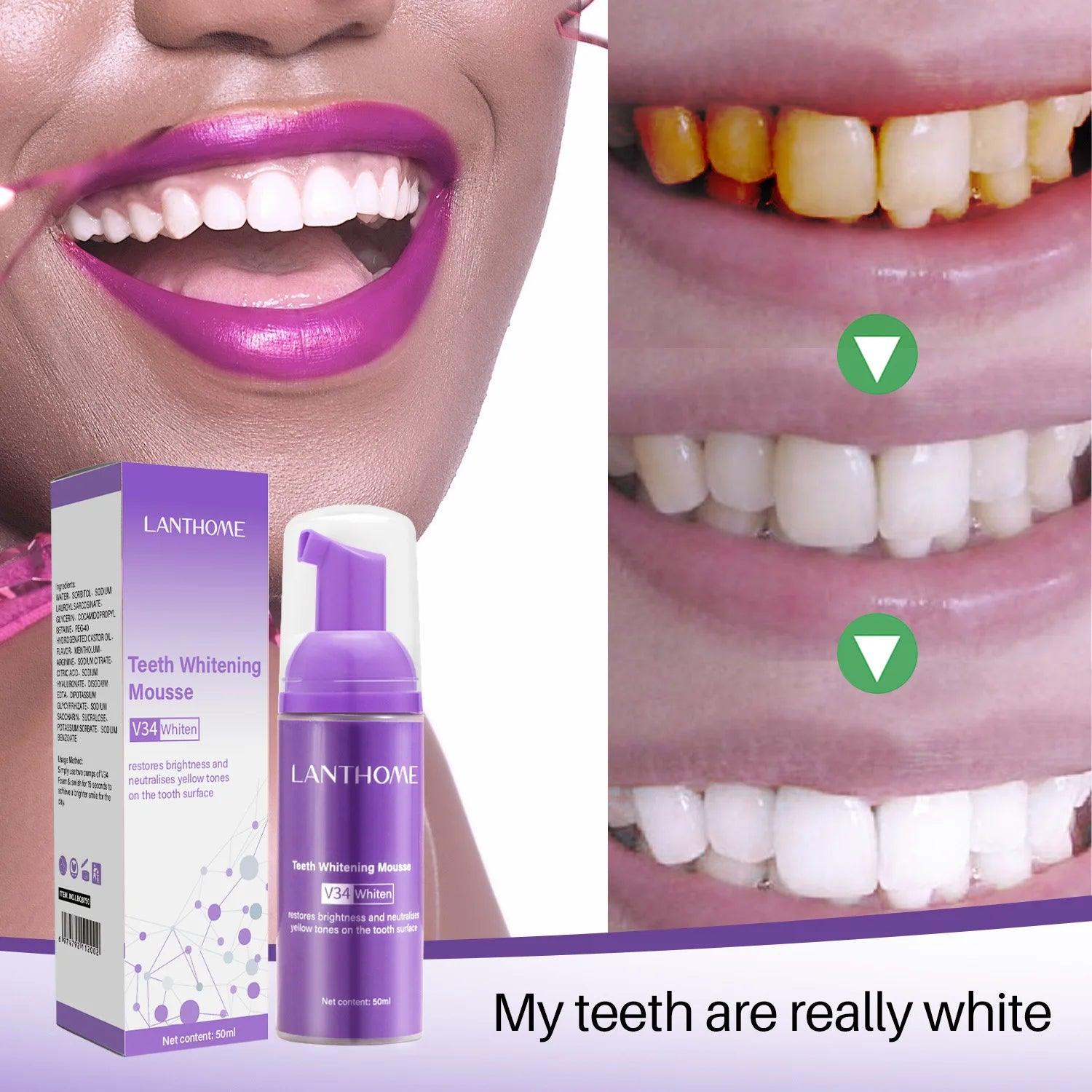 V34 Color Correction Teeth Whitening Foam - Trendy Mix