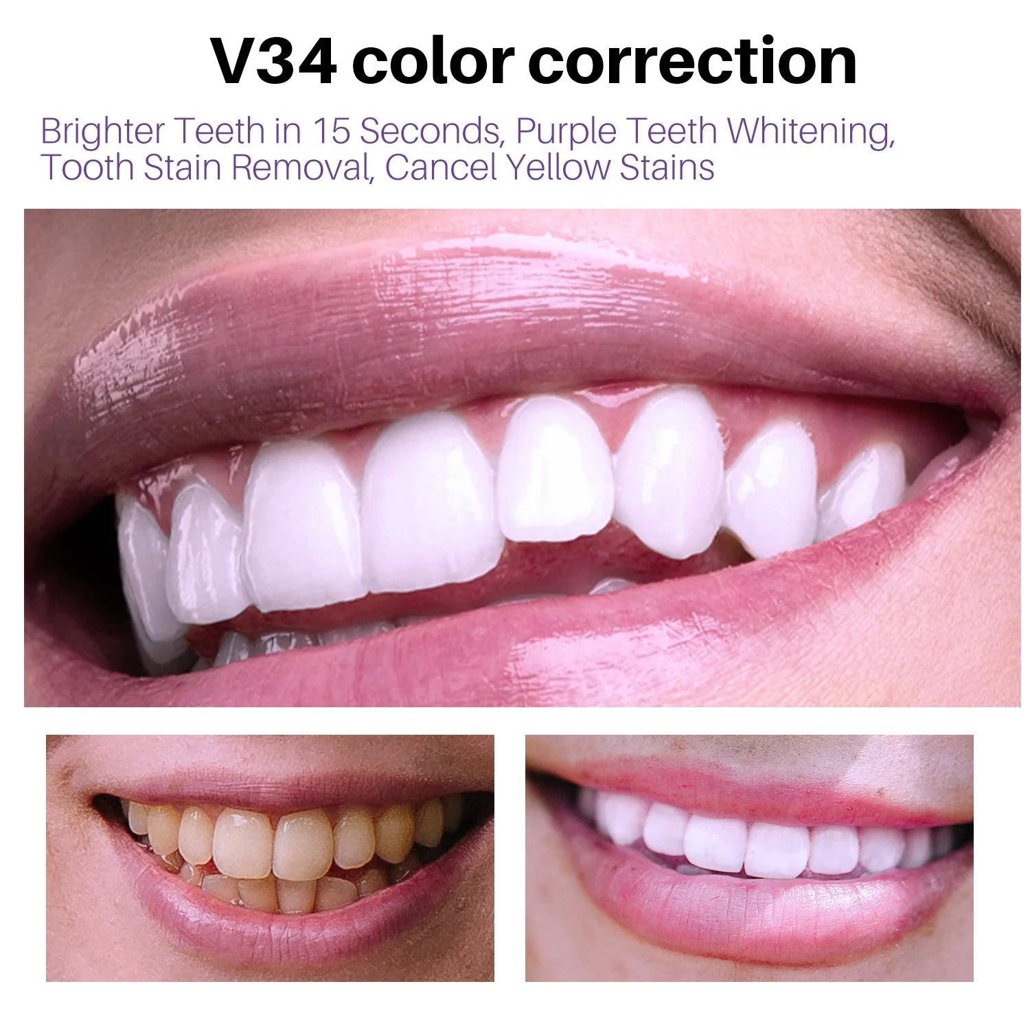 V34 Color Correction Teeth Whitening Foam - Trendy Mix