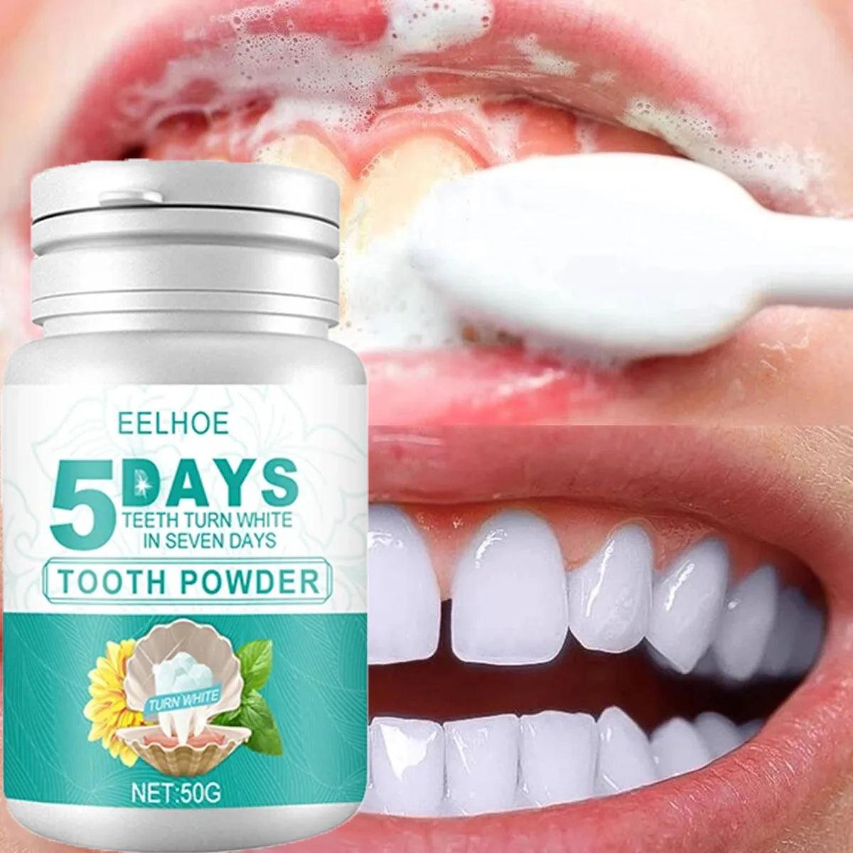 5-Day Instant Smile Whitening Powder - Trendy Mix