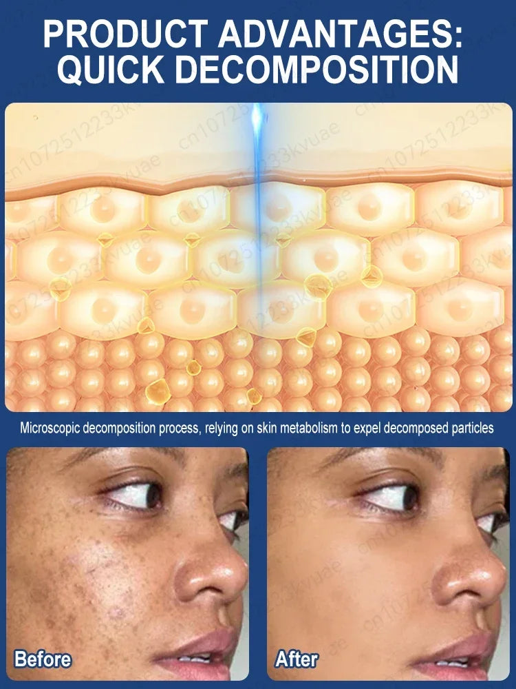 Sardine Remover + Essence: Quickly Removes Freckles, Dark Spots, Melasma, Age Spots, and Brightens Skin