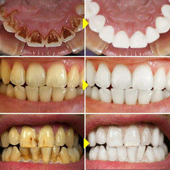 V34 Color Correction Teeth Whitening Foam - Trendy Mix