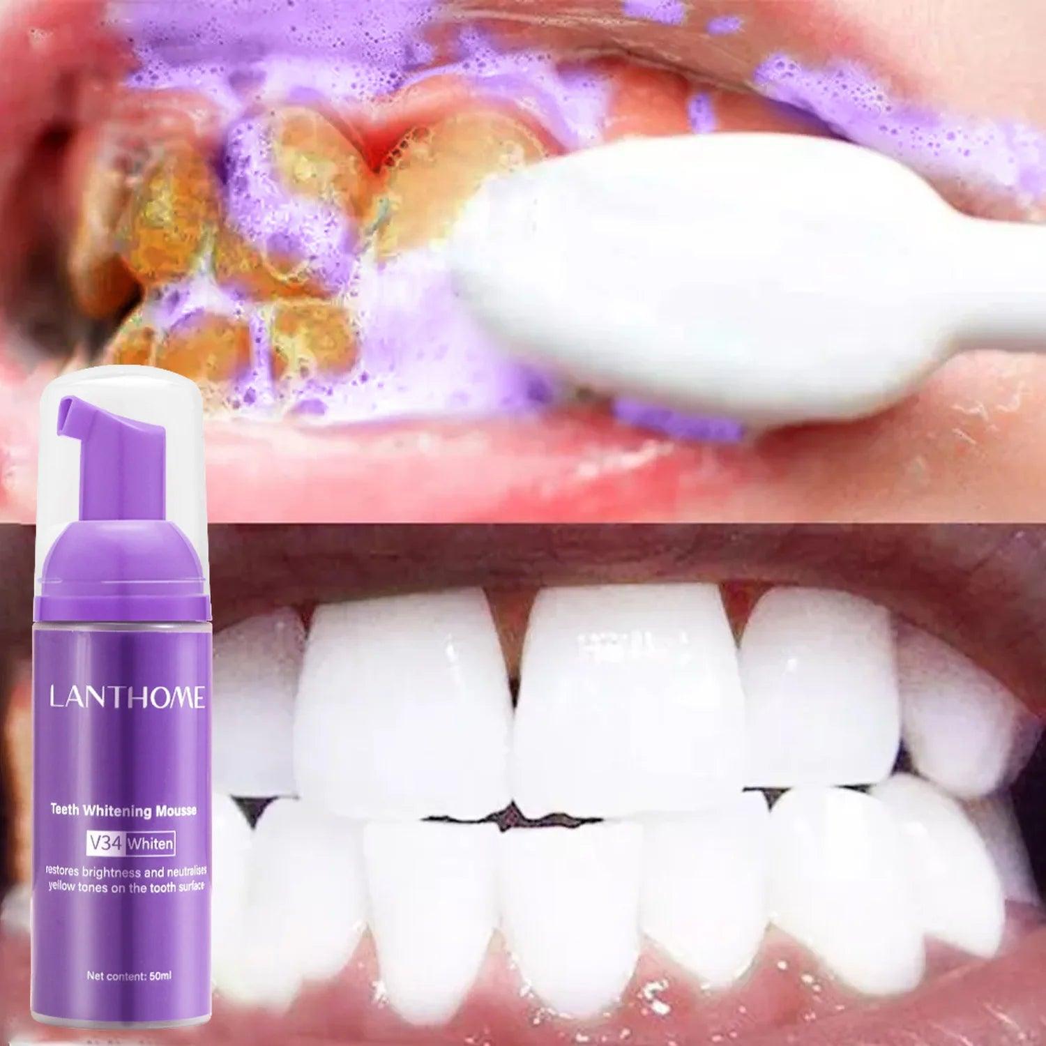 V34 Color Correction Teeth Whitening Foam - Trendy Mix