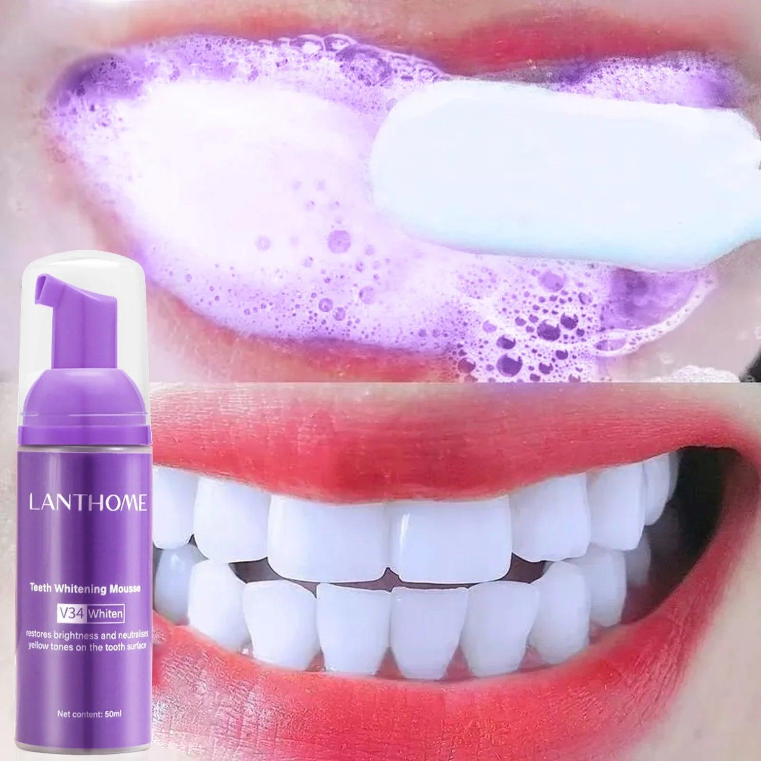 Brilliant White Teeth Whitening Mousse - Trendy Mix