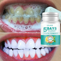 5-Day Instant Smile Whitening Powder - Trendy Mix