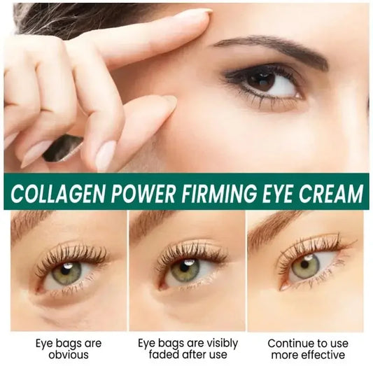 Effective Eye Cream: Reduces Dark Circles, Anti-Aging