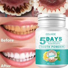 5-Day Instant Smile Whitening Powder - Trendy Mix