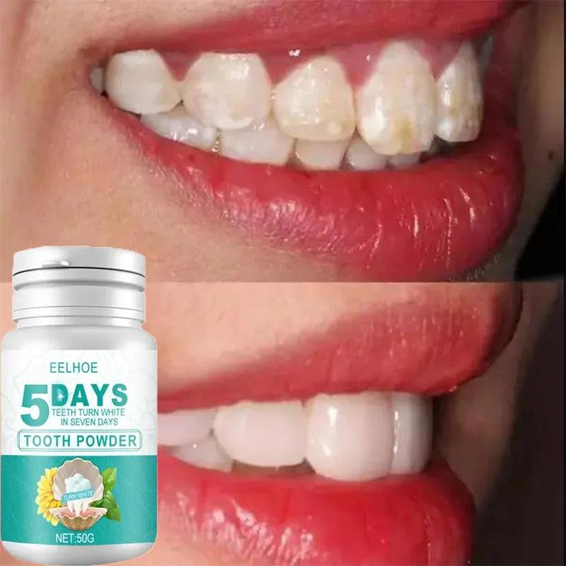 5-Day Instant Smile Whitening Powder - Trendy Mix