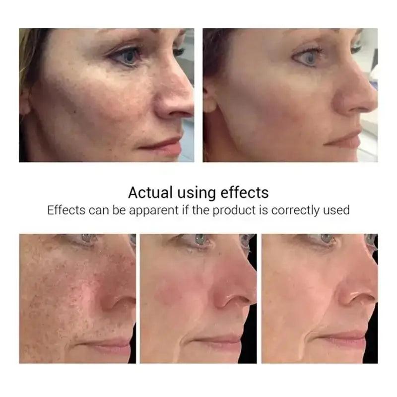 Effective Whitening Cream: Removes Melasma, Dark Spots, Moisturizes - Trendy Mix