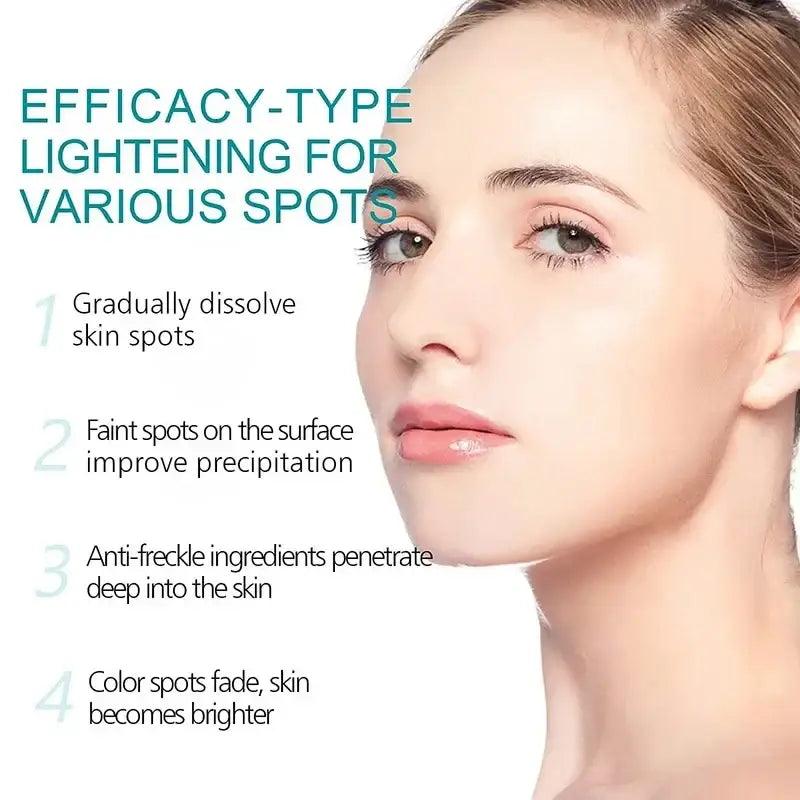 Effective Whitening Cream: Removes Melasma, Dark Spots, Moisturizes - Trendy Mix