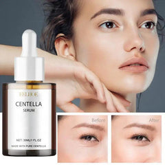 Korean Radiant Centella Facial Serum - Trendy Mix