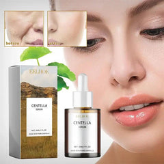 Korean Radiant Centella Facial Serum - Trendy Mix