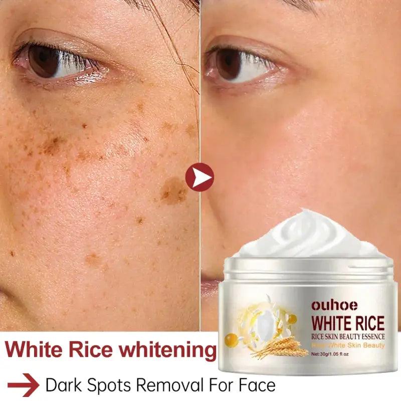 White Rice Whitening Face Cream: Removes Dark Spots, Anti-wrinkle - Trendy Mix