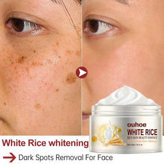 White Rice Whitening Face Cream: Removes Dark Spots, Anti-wrinkle - Trendy Mix