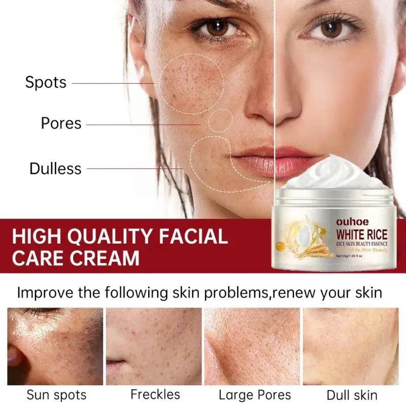 White Rice Whitening Face Cream: Removes Dark Spots, Anti-wrinkle - Trendy Mix